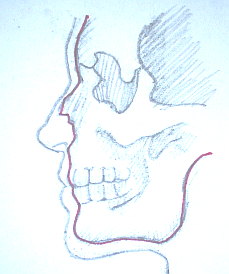 howtodrawnosecartilage.jpg